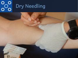 Dry Needling